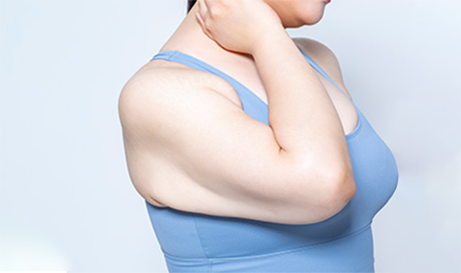 다이어트 실패 경험